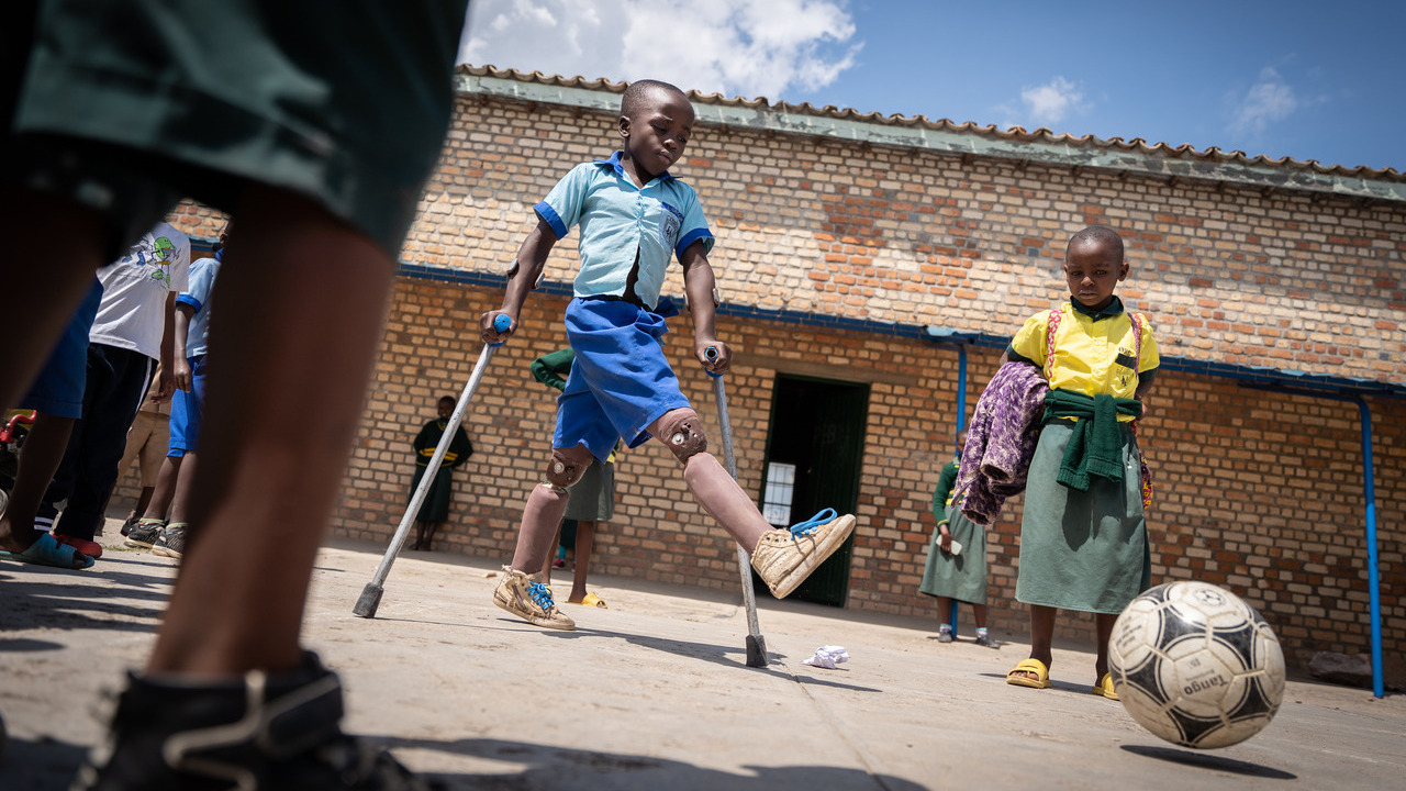 Longini here playing football in the courtyard at school after he received his new prostheses.